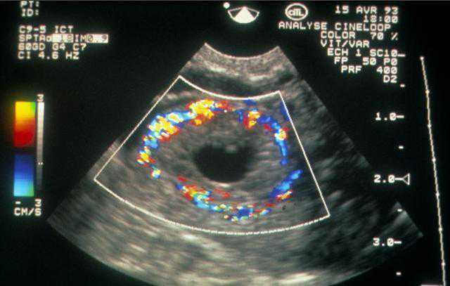 武汉代怀服务价格,卵巢早衰可以做美国试管婴儿吗？