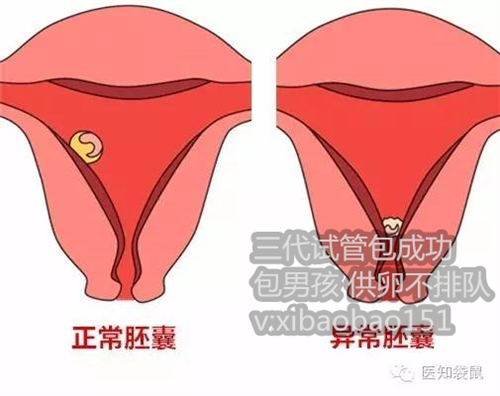 武汉捐卵给多钱,刘诗诗被曝怀孕六个月 知情人：赴美试管造人 一次花费20万